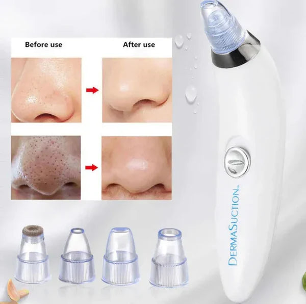DERMA SUCTION | Pore Vacuum Cleaner