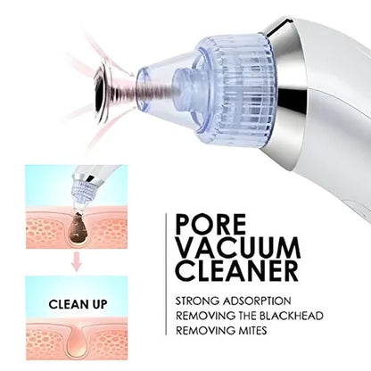 DERMA SUCTION | Pore Vacuum Cleaner