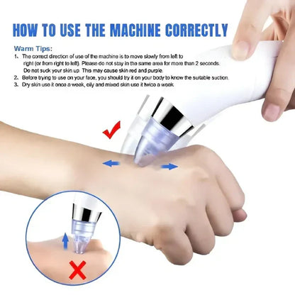 DERMA SUCTION | Pore Vacuum Cleaner