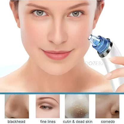 DERMA SUCTION | Pore Vacuum Cleaner